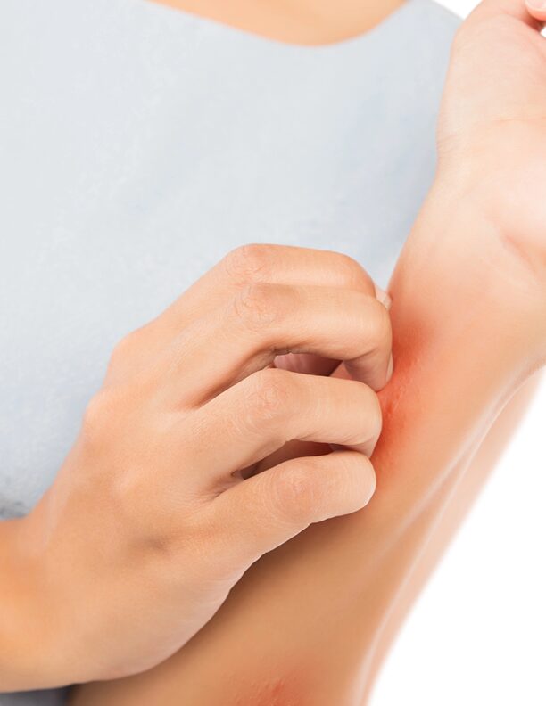 Blogfoto- gesunde Haut